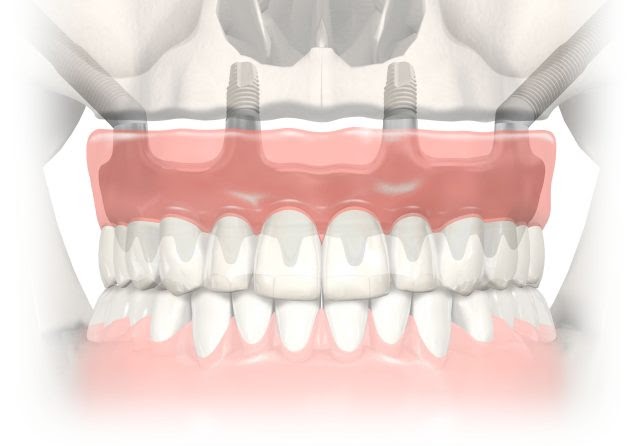 Dental Premier photo 6